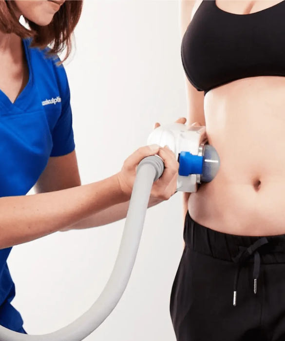 CoolSculpting - Maria Clara de Paula