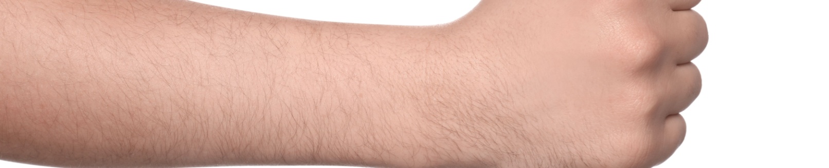 Técnica Body Hair (Uso de Pelos Corporais para Transplante Capilar)
